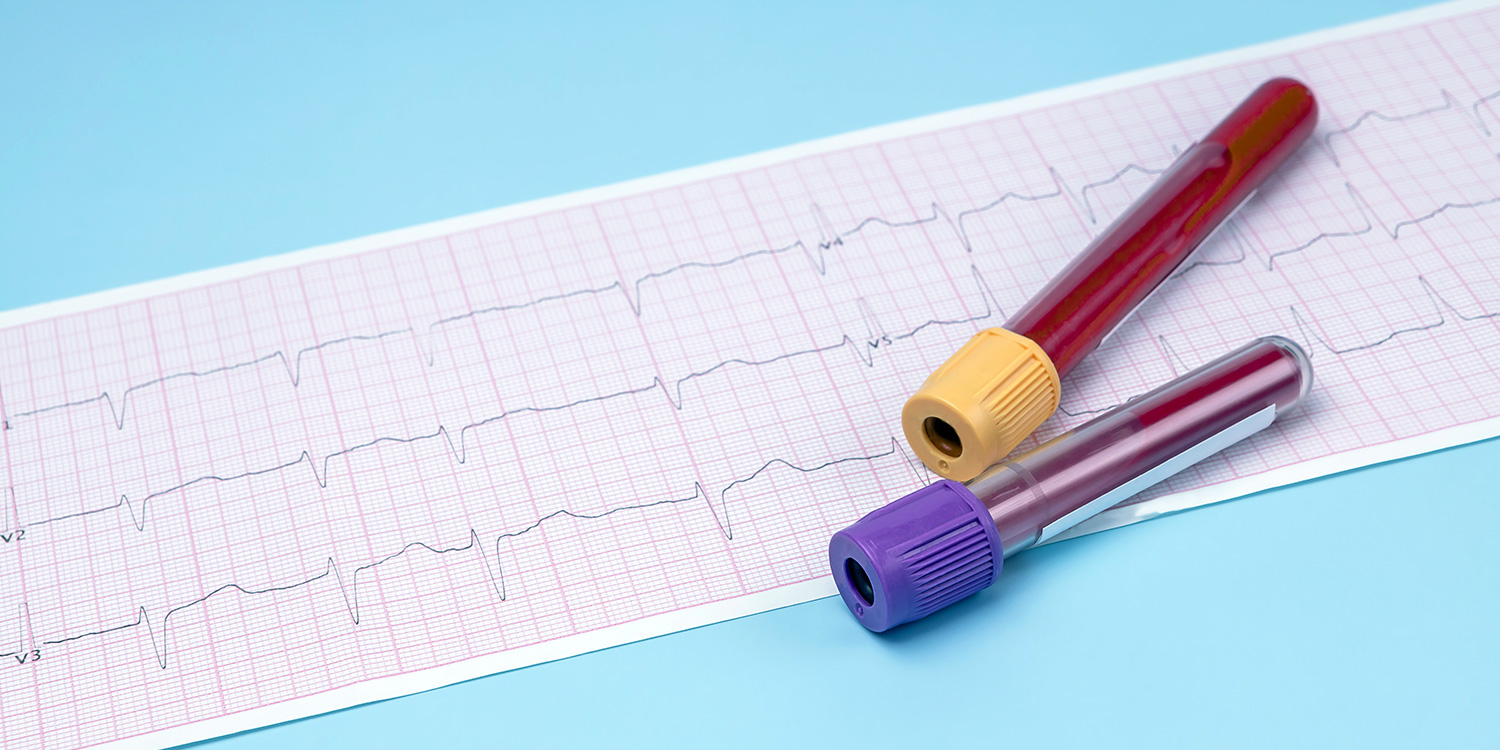 pCardiac Marker Test Kits
