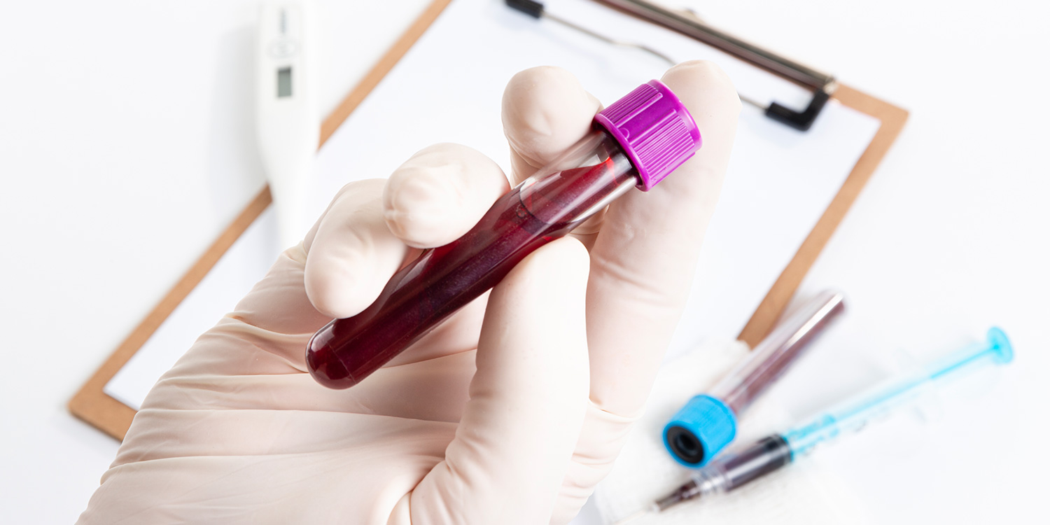 pTumor Marker Test Kits